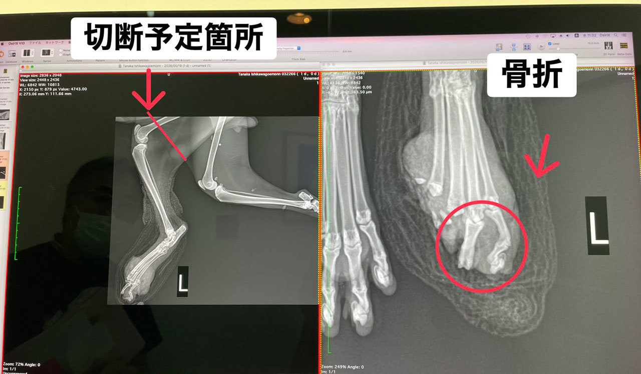 術前のレントゲン.jpg